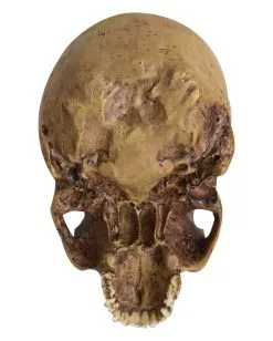 Antiker Totenschädel Ohne Unterkiefer 19cm 7 Antiker Totenschädel Ohne Unterkiefer 19cm -Karneval Universe Verkäufe antiker totenkopf ohne unterkiefer antiker totenschaedel ohne unterkiefer gothic deko 53262 04